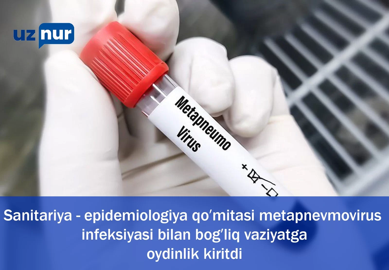 Sanitariya-epidemiologiya qo'mitasi metapnevmovirus infektsiyasi bilan bog'liq vaziyatga oydinlik kiritdi