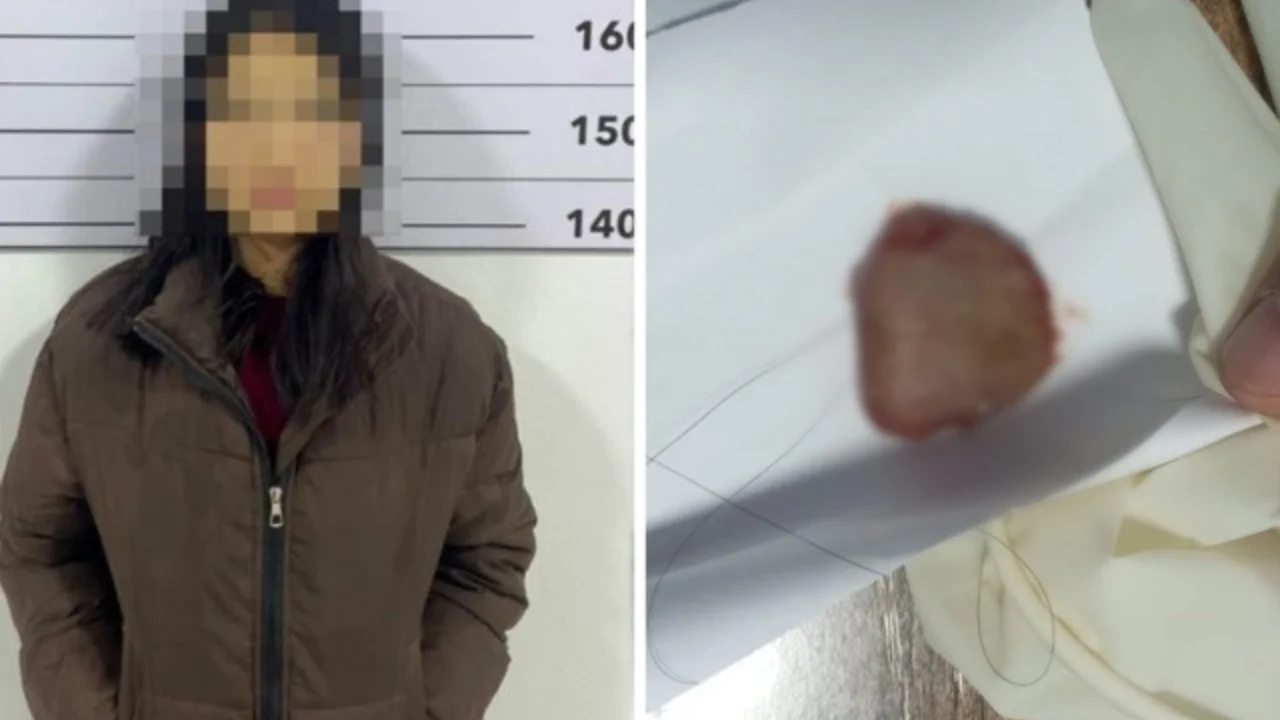 19 yoshli qiz yigitning tilini tishlab, uzib oldi