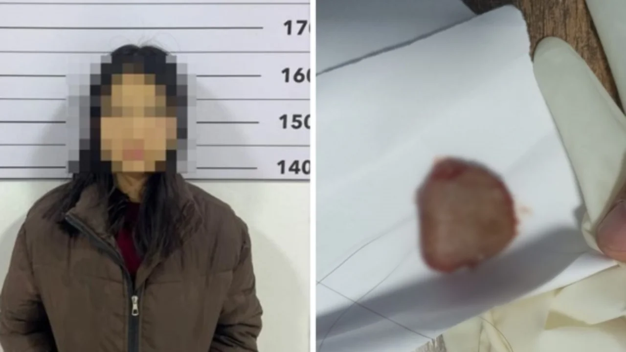 Qirg‘izistonda 19 yoshli qiz sevgilisining tilini tishlab, uzib oldi