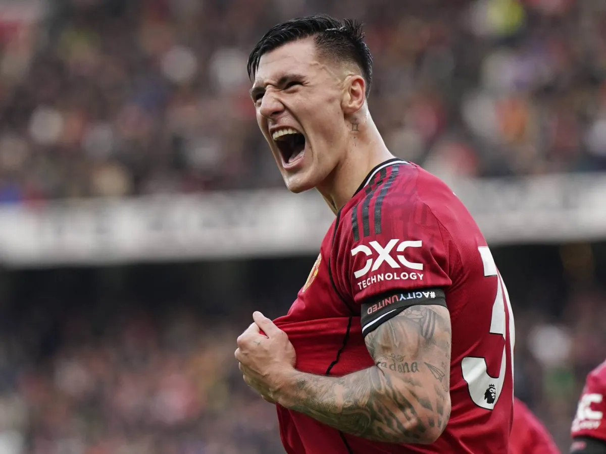 Manchester Yunayted hujumchisi oy davomida maydonga tusha olmaydi