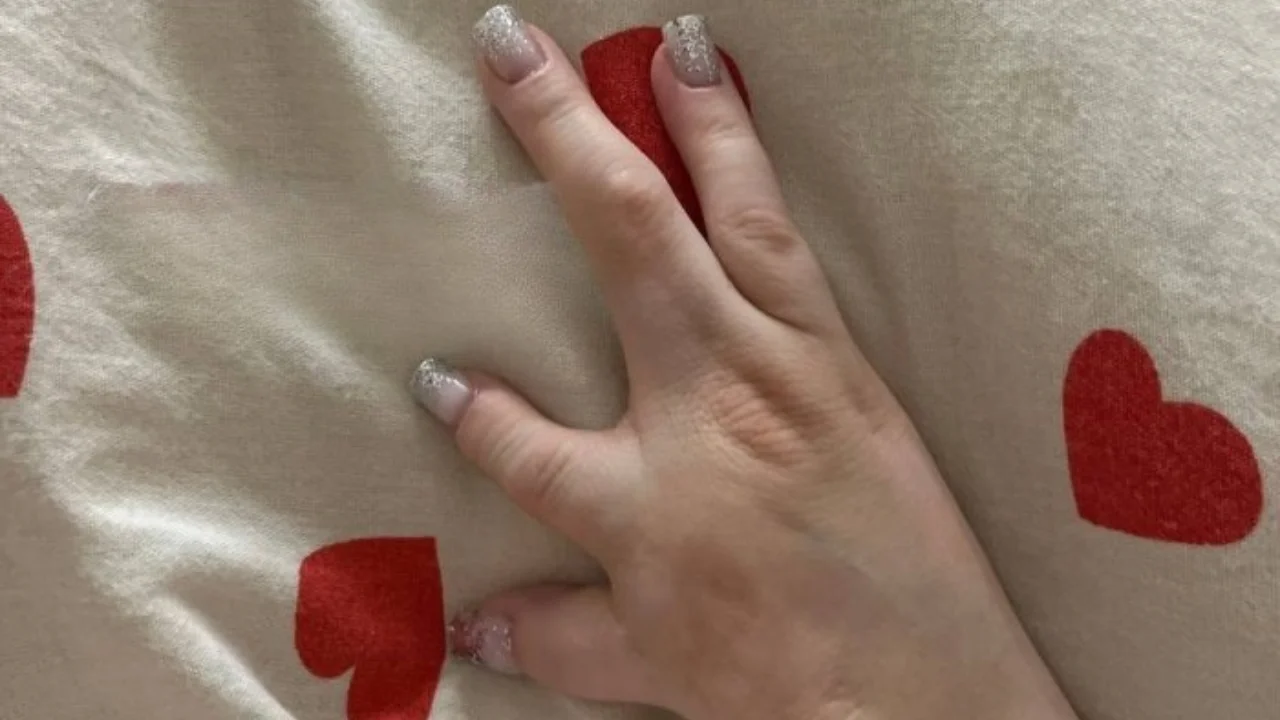 Murmanskda qizning bir barmog‘i yo‘qligi uchun ishdan haydashdi